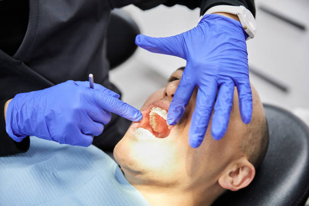 Best Emergency Treatment for Dental Infections or Abscesses in Cudjoe Key, FL