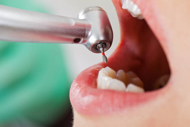 Best Emergency Gum Treatment in Cudjoe Key, FL